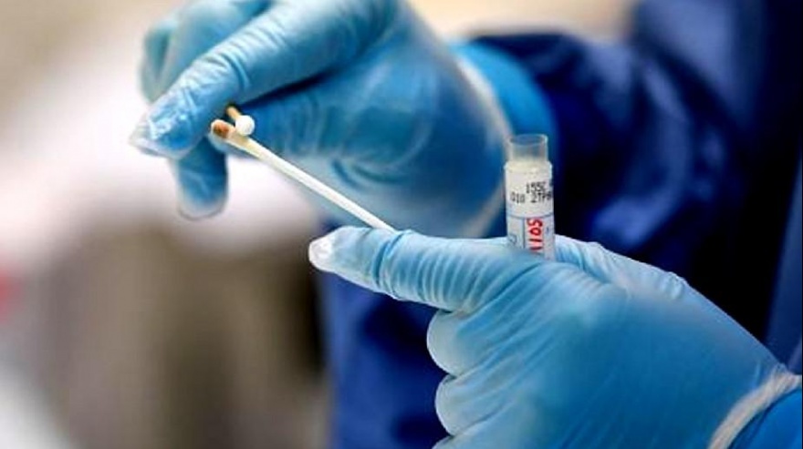 Reportan caso de un hombre reinfectado por coronavirus en Estados Unidos