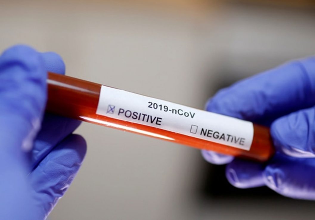 Coronavirus