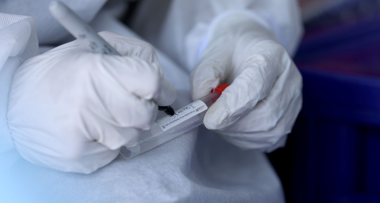 Ministerio de Salud reporta 171 casos nuevos de coronavirus