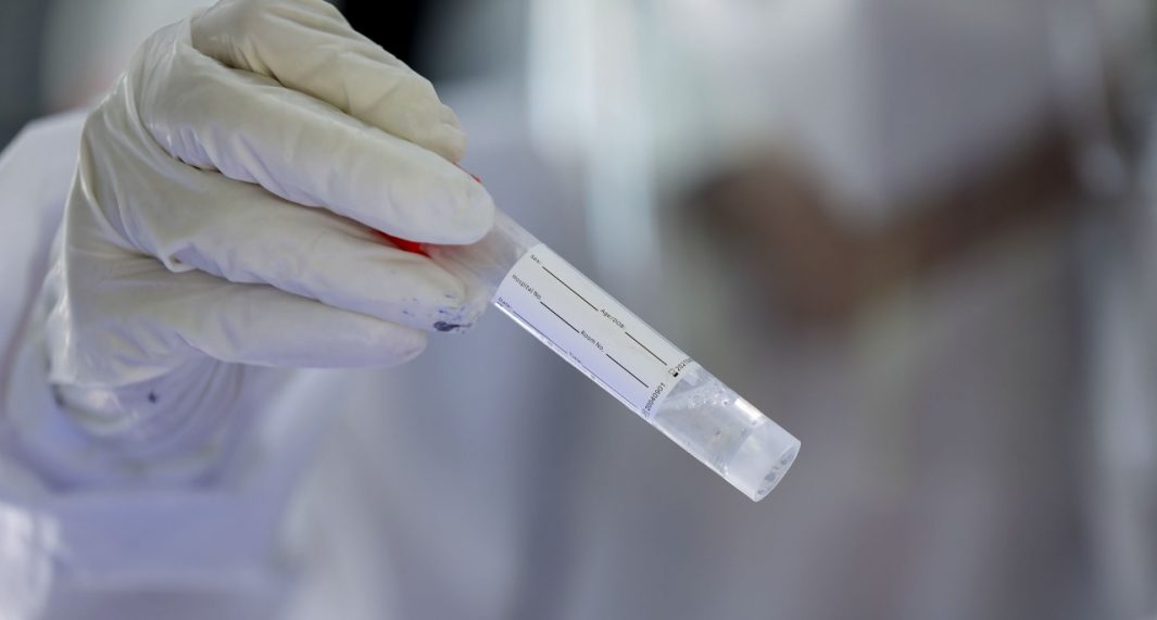Coronavirus
