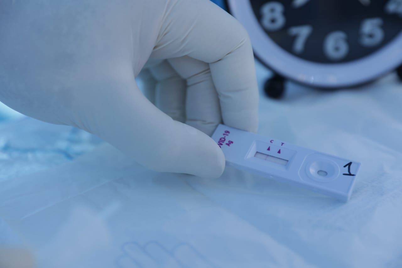Total de casos de coronavirus en el mundo cerca de 45 millones