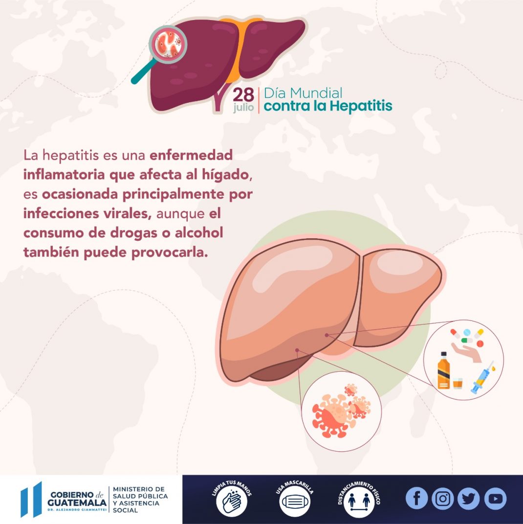 Día Mundial contra la Hepatitis: Qué es y cómo prevenir esta enfermedad