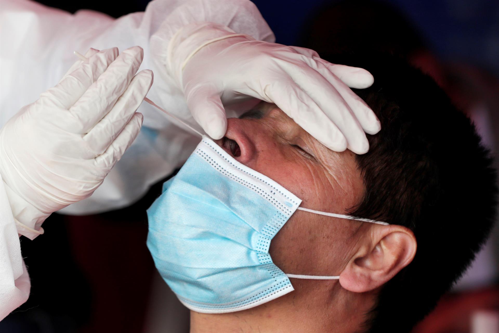 La OMS no ha declarado oficialmente al COVID-19 una “infección endémica”