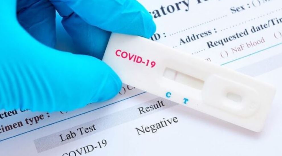 OMS y CSIC acuerdan la cesión global de la licencia de un test covid español