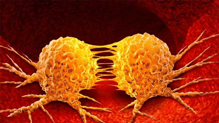 Científicos alemanes hallan el gen clave en el desarrollo de cáncer linfático