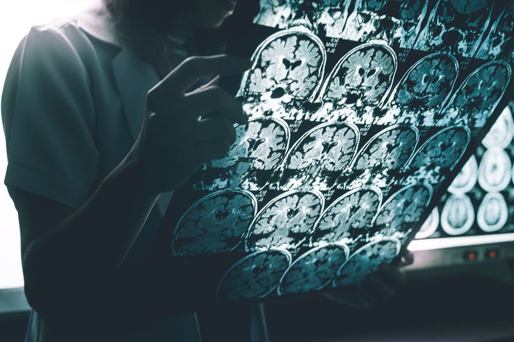 Crean sonda que emplea la luz para diagnosticar patologías cerebrales