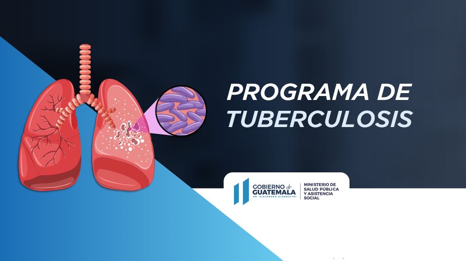 Ministerio de Salud recuerda importancia de prevenir tuberculosis