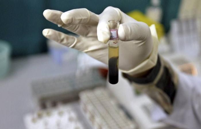 Brasil monitorea 28 casos sospechosos de hepatitis infantil aguda