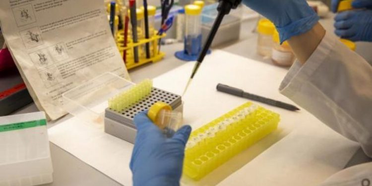 Ministerio de Salud tiene capacidad para detectar viruela del mono