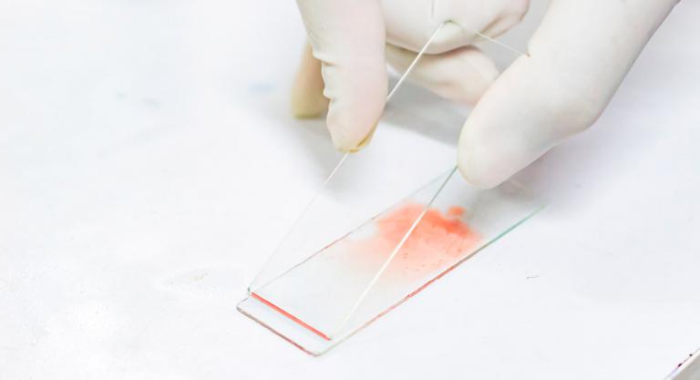 Impulsan un proyecto para optimizar el diagnóstico de enfermedad de Chagas en Suramérica
