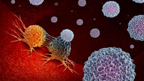 Identifican proteína que impide que inmunoterapia contra el cáncer funcione