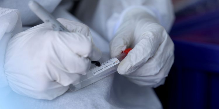 OMS espera en 2023 reducción significativa de COVID-19 y viruela símica