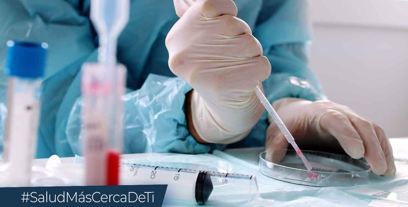 Aumentan los pacientes recuperados de viruela símica en Guatemala