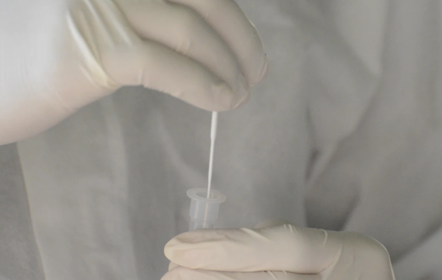 Covid-19: Variante XBB de ómicron es la más frecuente en el país