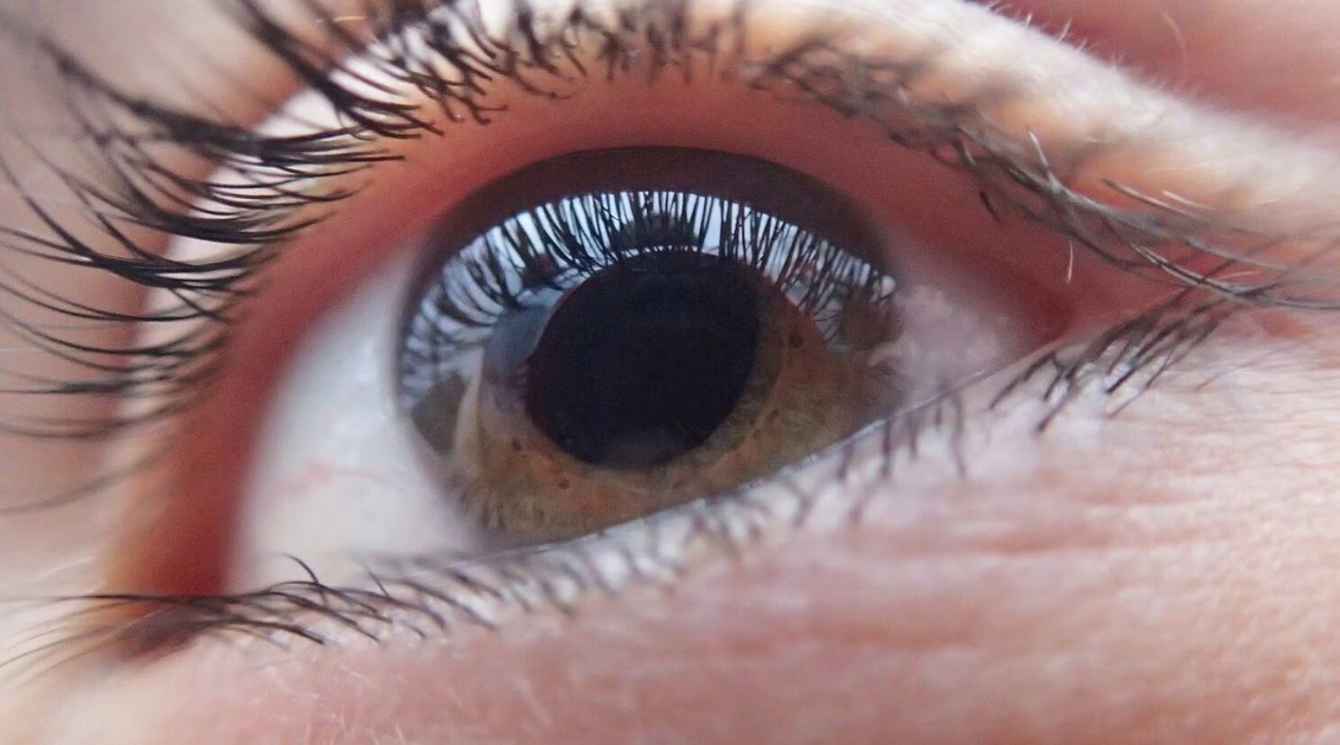 Italiano recupera la vista gracias a una inédita reconstrucción ocular