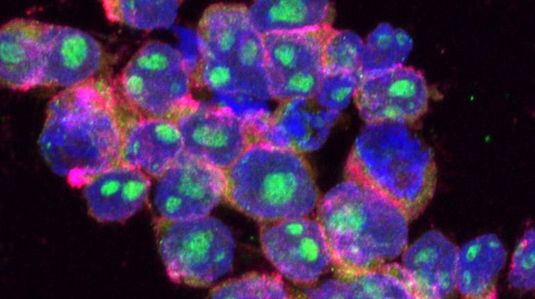 Crean nanocápsulas con control remoto para ampliar efecto de quimioterapias