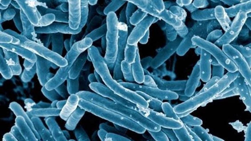 OMS refuerza lucha contra tuberculosis para su erradicación en 2030