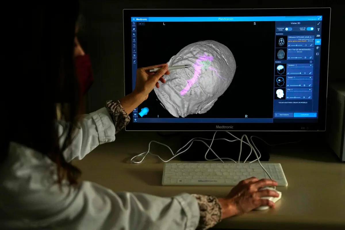 Zonas del cerebro dañadas por la hipertensión afectan en la demencia