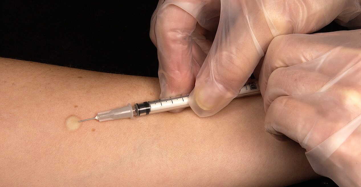 Salud promueve detección y tratamiento oportuno de la tuberculosis en Retalhuleu