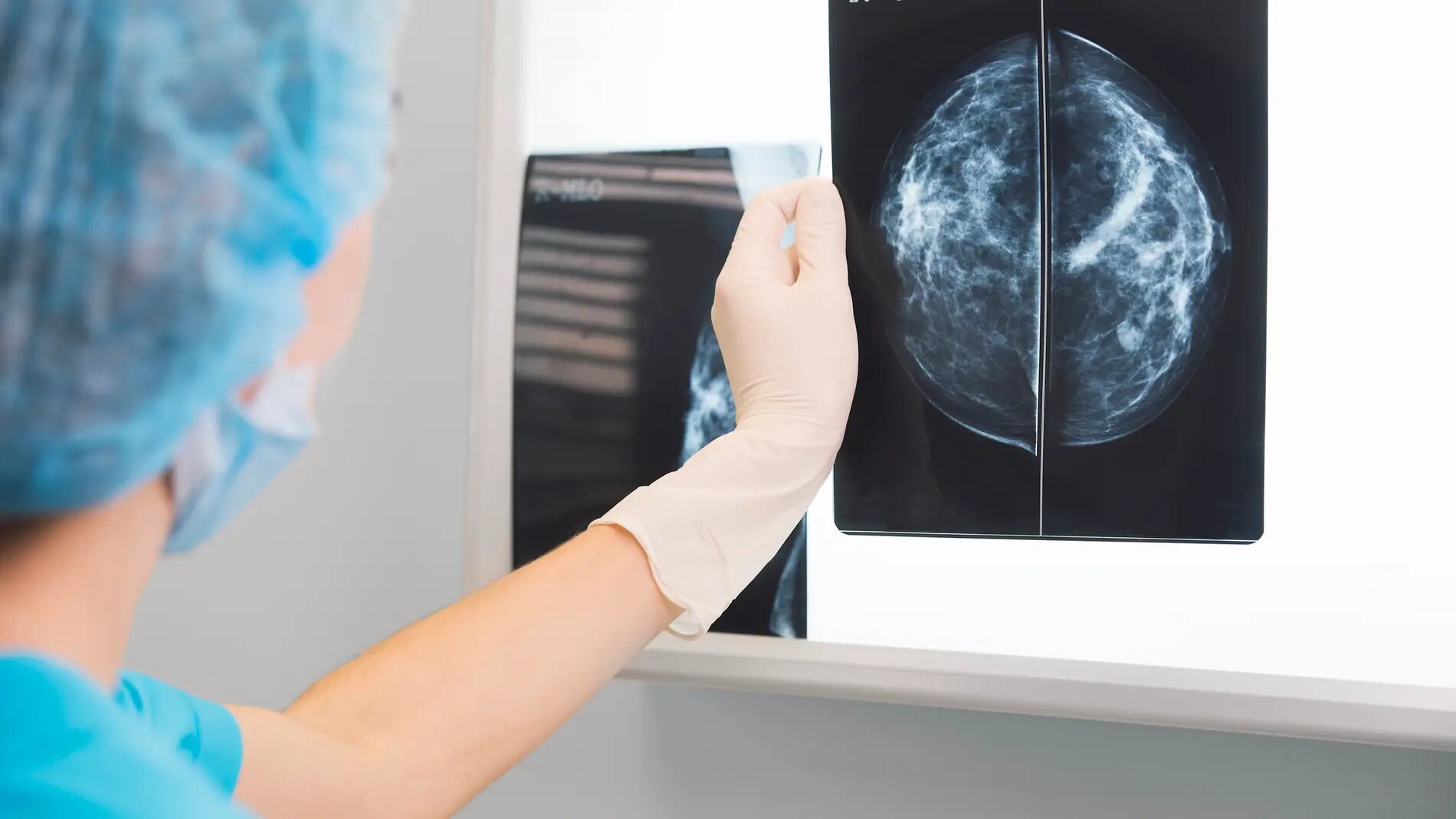 Un estudio internacional avala el papel de la terapia endocrina contra el cáncer
