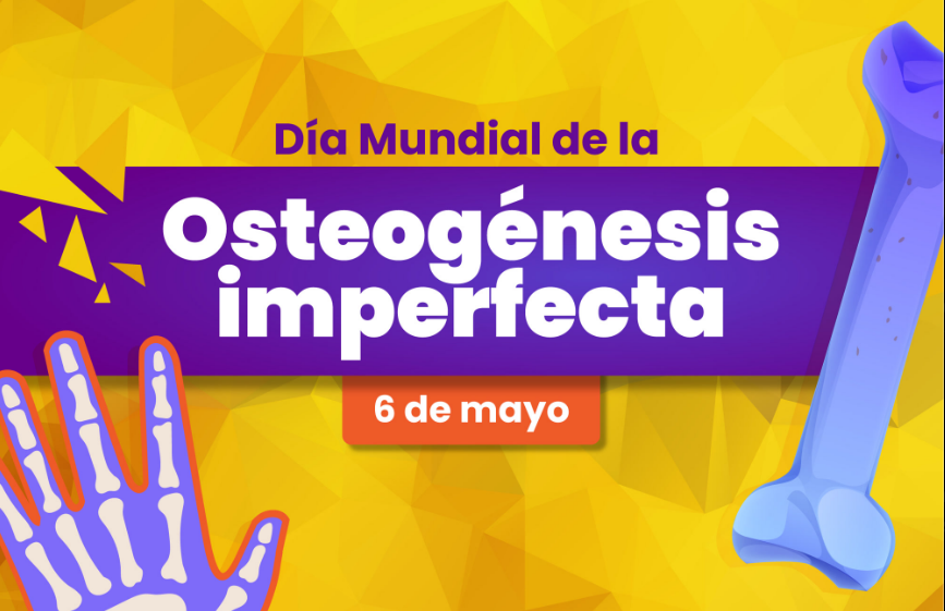 Comparten información sobre la osteogénesis imperfecta