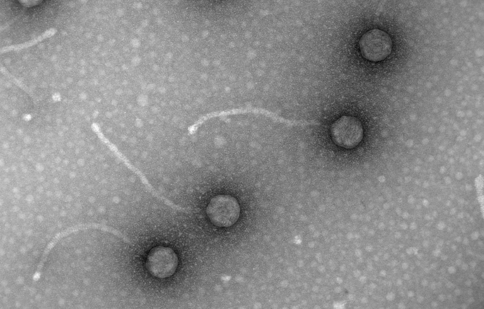 Micrografías de fagos, virus de bacterias, obtenidas en el laboratorio de Virología Ambiental y Biomédica del Instituto de Biología Integrativa de Sistemas (UV-CSIC). / Foto: EFE, Imagen facilitada por la investigadora Pilar Domingo-Calap.