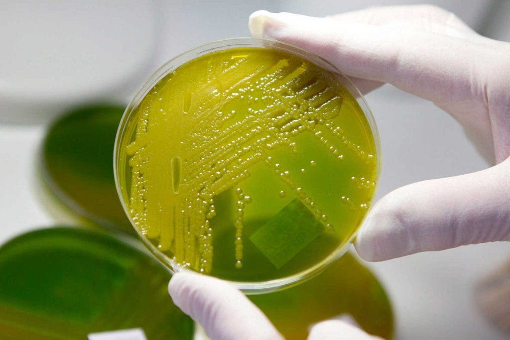 Nuevo antibiótico es prometedor, en ratones, contra una bacteria multirresistente