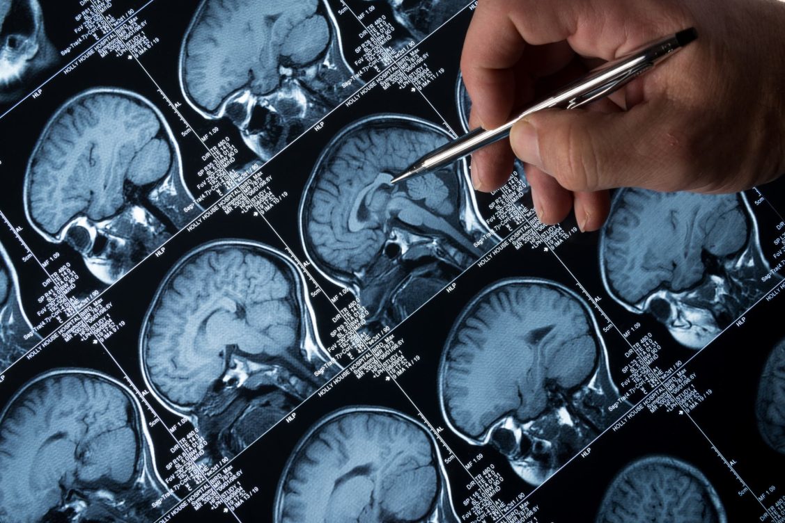 El cerebro se adapta a lo "inusual". / Foto: EFE.