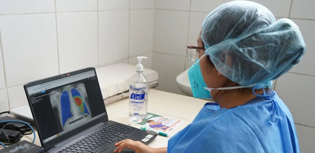 ¡Sí! ¡Podemos poner fin a la tuberculosis! el lema de Salud para este 24 de marzo