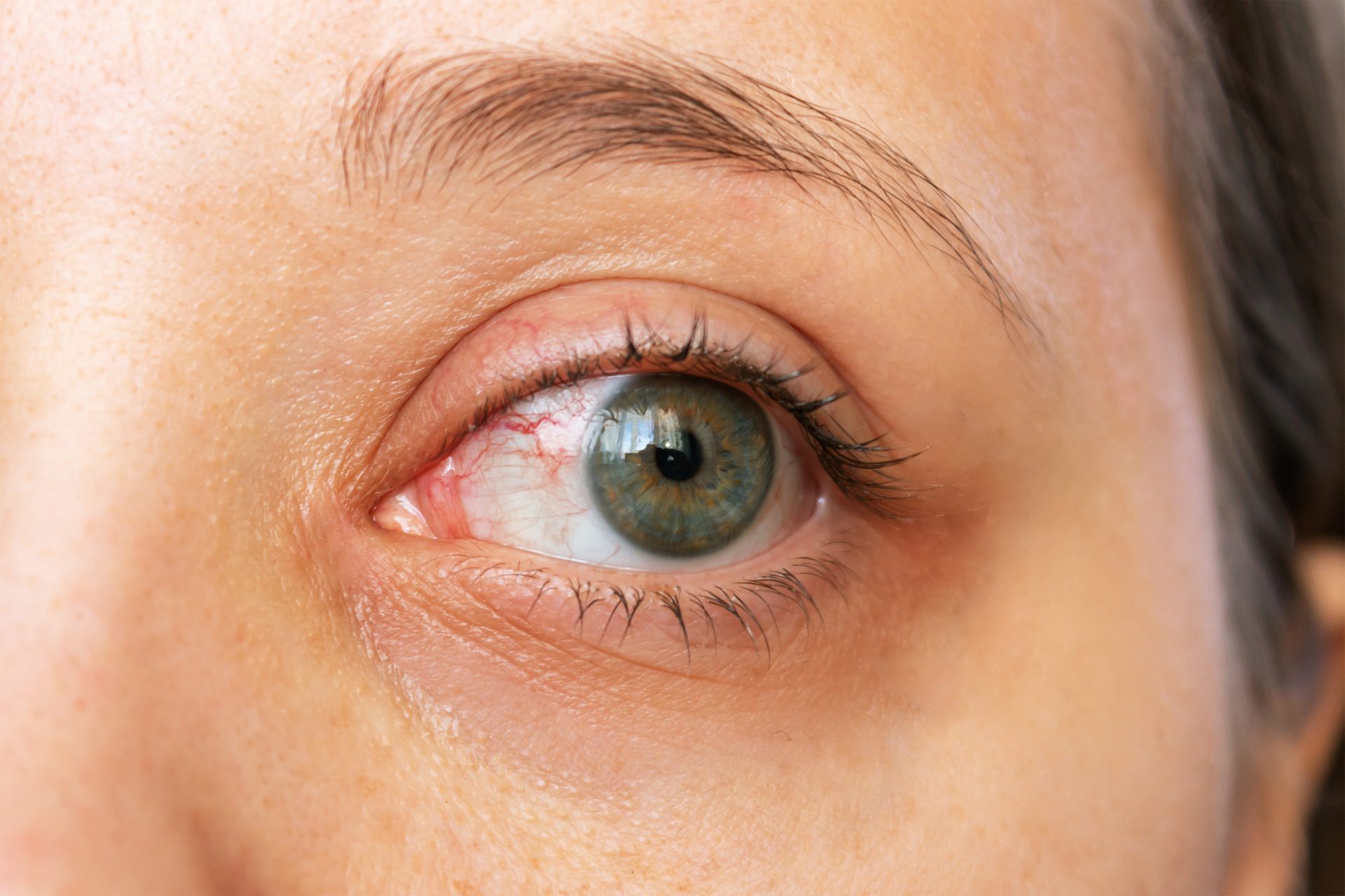 Técnica ayuda a recobrar visión en casos de ceguera hereditaria. / Foto: EFE Salud.