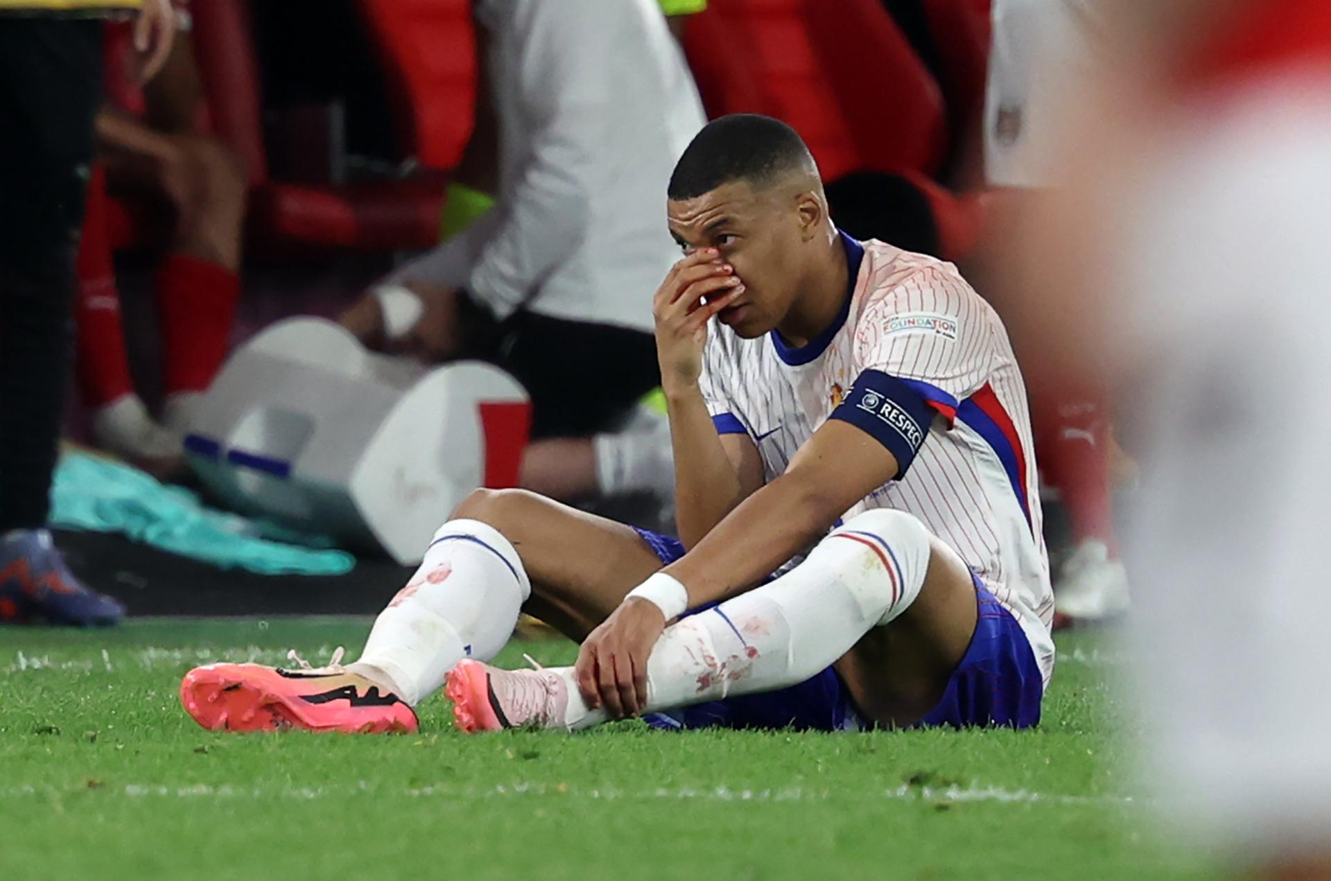 Eurocopa 2024: Mbappé sufre fractura de nariz y será operado en hospital de Düsseldorf