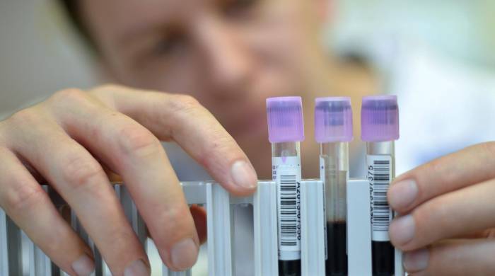 Con un análisis de sangre se puede predecir con anticipación de siete años si una persona desarrollará párkinson.