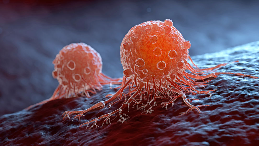 Una combinación de inmunoterapias mejora la respuesta al cáncer