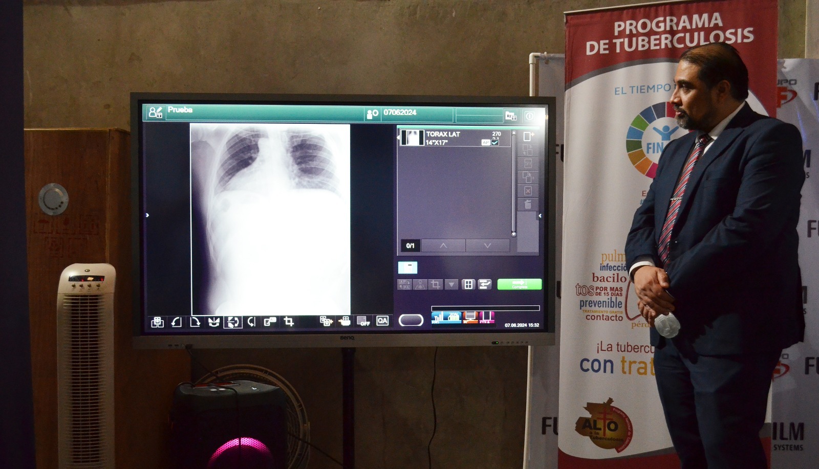 Entregan equipo para el diagnóstico de la tuberculosis en Huehuetenango y San Marcos