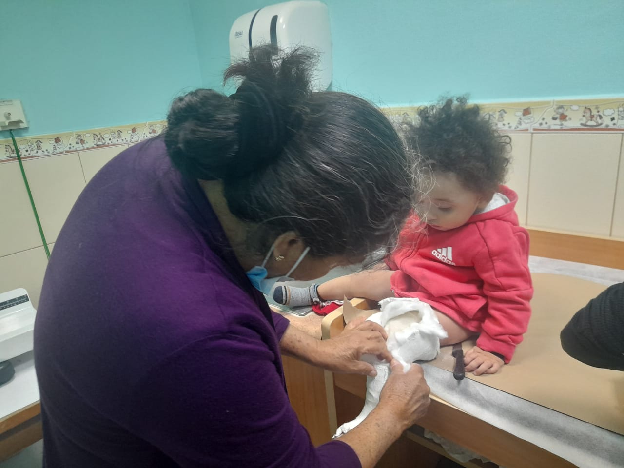 Médicos del IGSS tratan, con éxito, el pie equino de un bebé