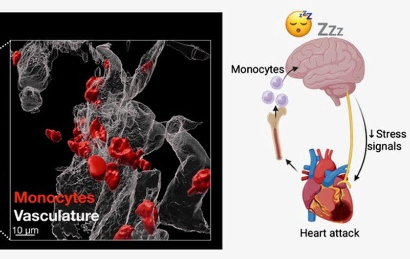 El corazón envía señales al cerebro para dormir más y mejorar recuperación tras un infarto