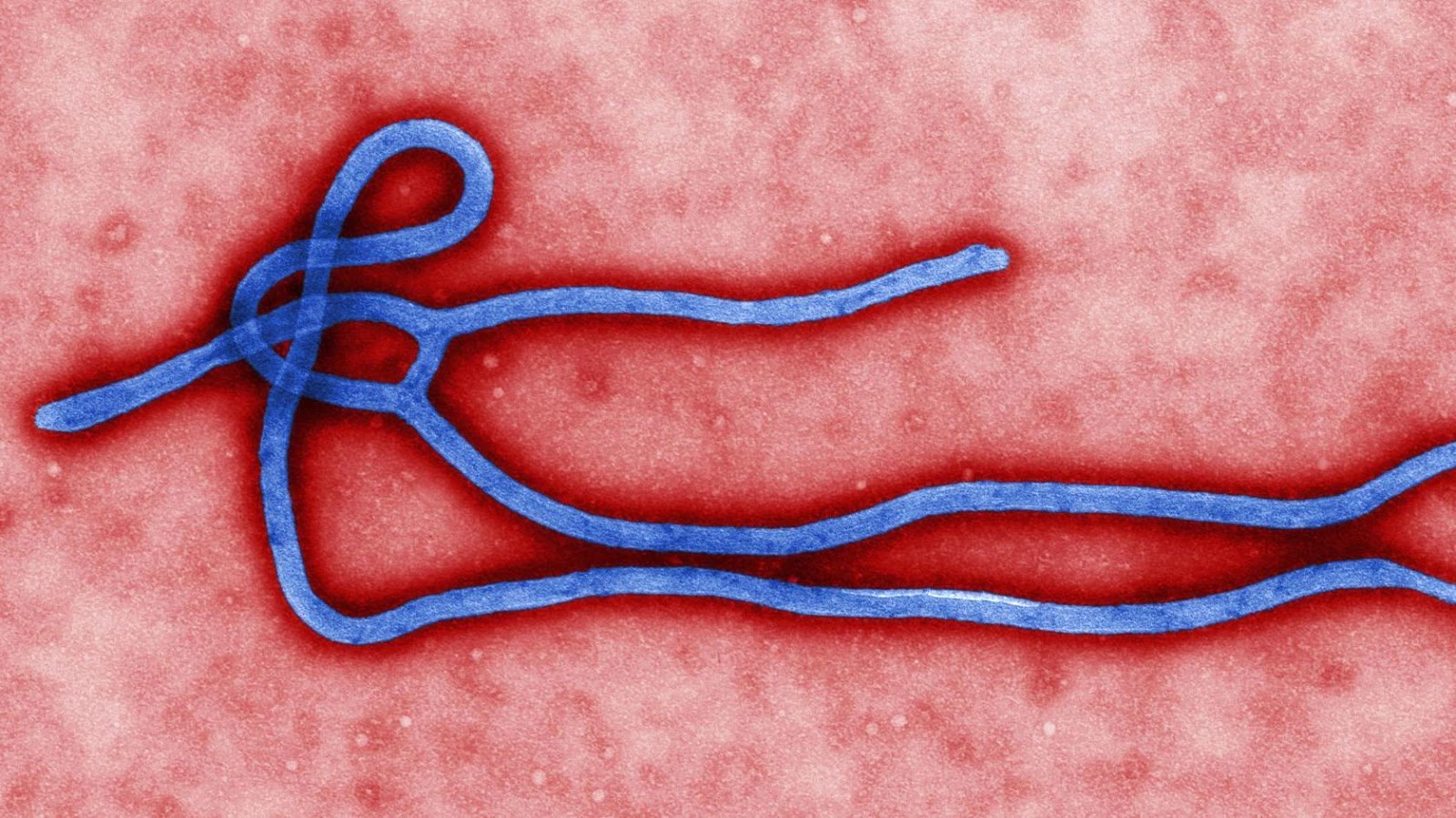 Virus del ébola ingresa por la piel humana. / Foto: microBIOblog.