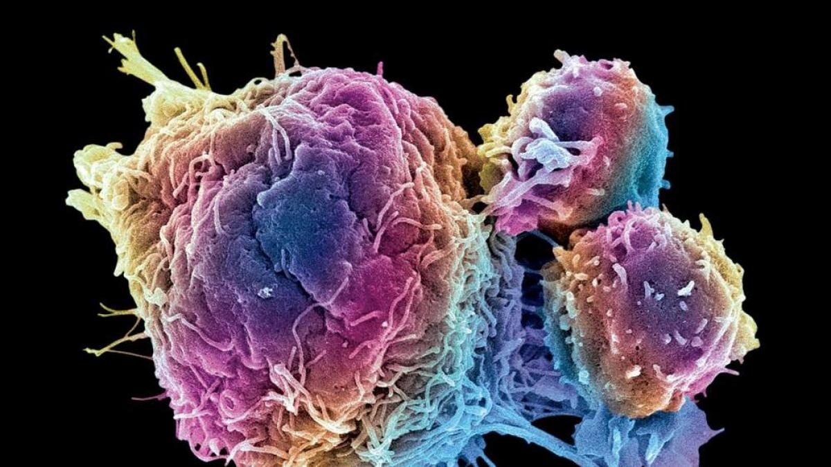 Células grasas modificadas muestran capacidad para absorver el cáncer.