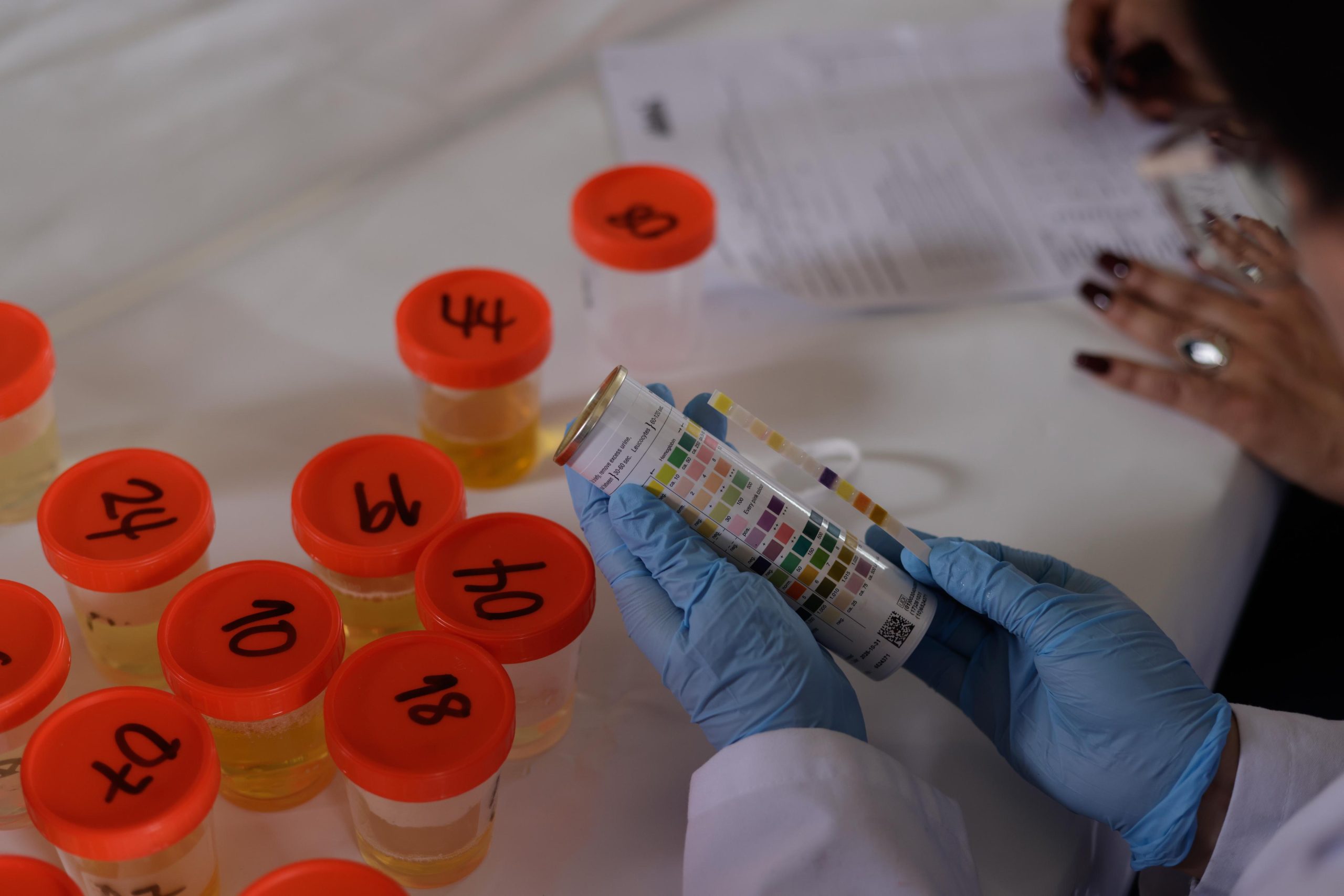 Ministerio de Salud realiza jornadas de tamizaje renal, por el Día del Riñón