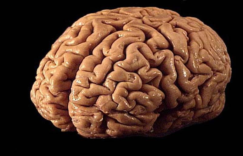 Estudio revela cómo los microplásticos se acumulan peligrosamente en el cerebro. / Foto: Universidad de Chile.