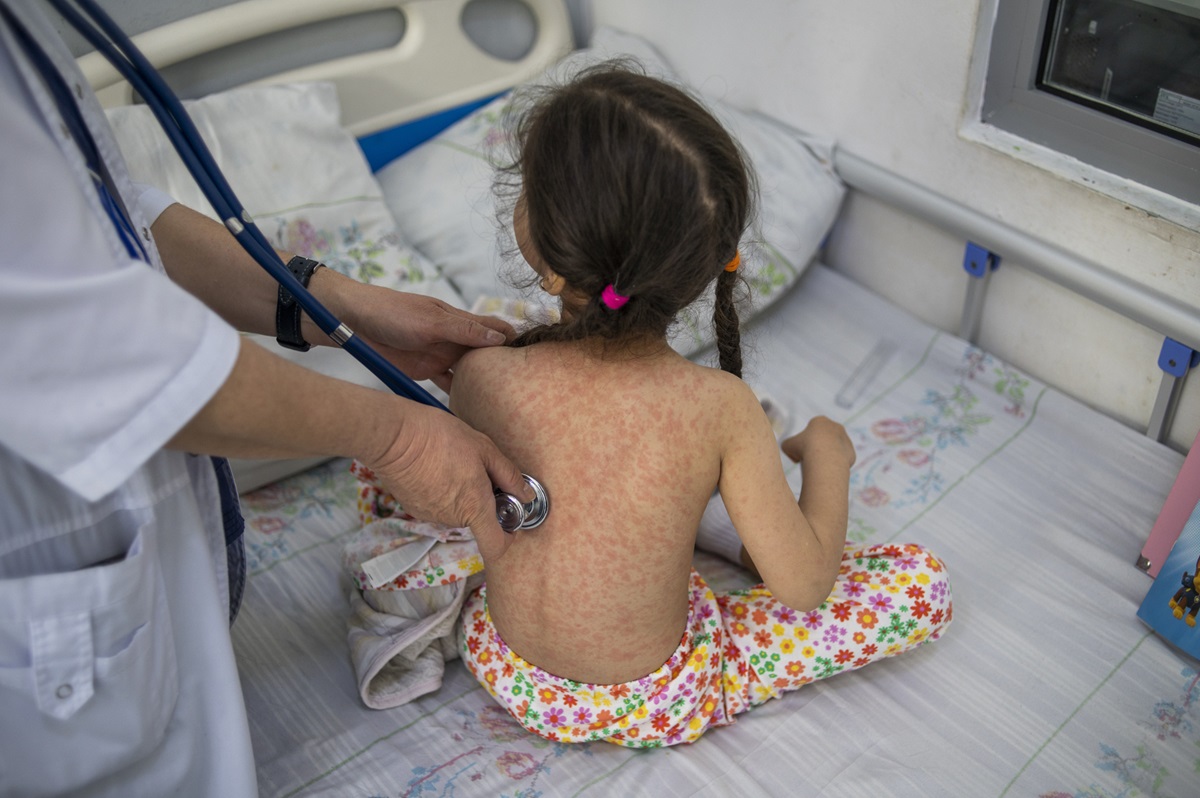 Ministerio de Salud intensifica seguimiento a contactos de pacientes con sarampión y vacunación