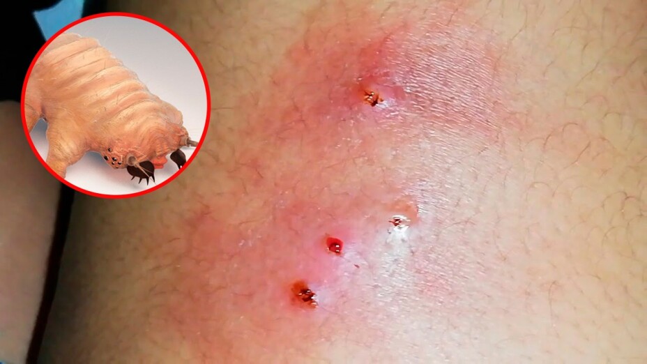 La mosca deposita sus huevesillos en heridas de animales o humanos y estos se convierten en larvas que se alimentan de tejido vivo.