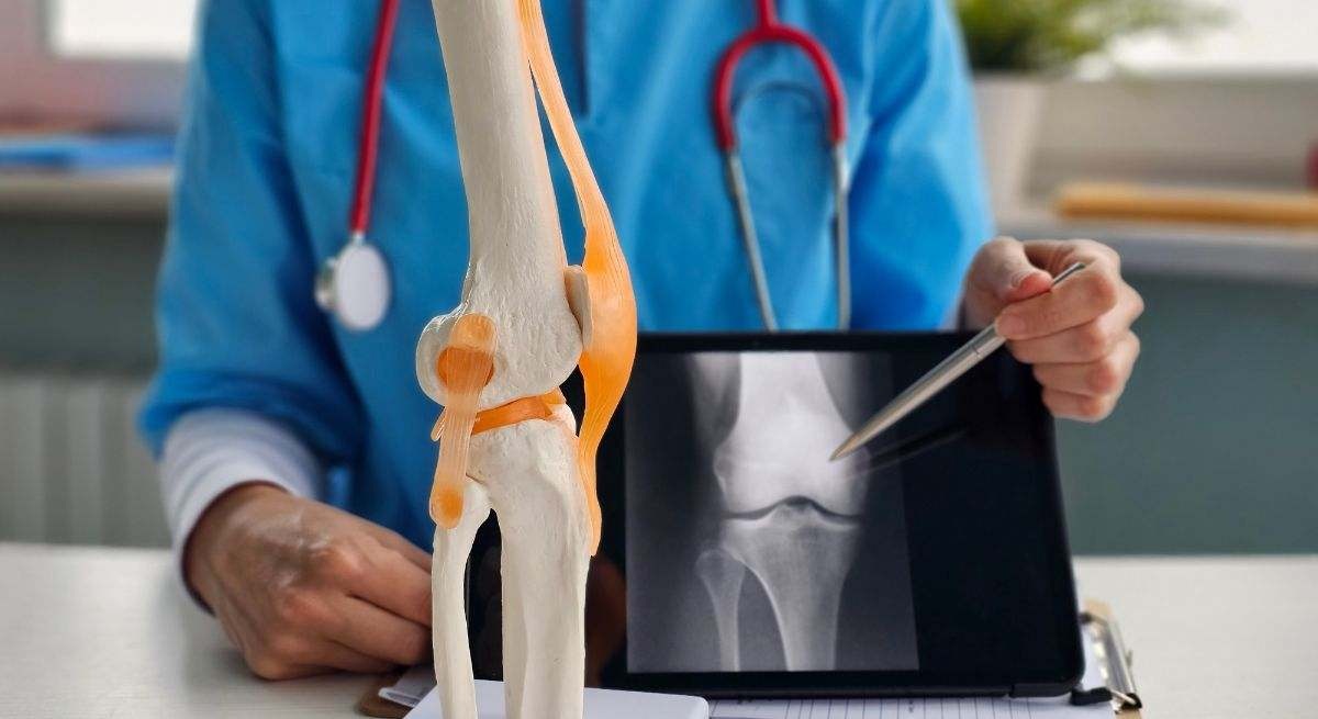 El uso de fármaco contra la gota abre nueva puerta para tratamiento de la osteoporosis.